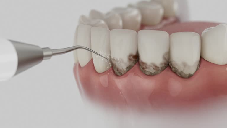 Reliable Invisalign Clear Aligners contractor in Allendale, SC by Smile Center Dentistry